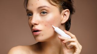 一个女人的面开枪痘痘在她的脸上拿着管