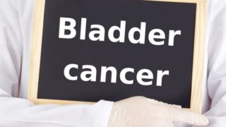 膀胱癌写在黑板上