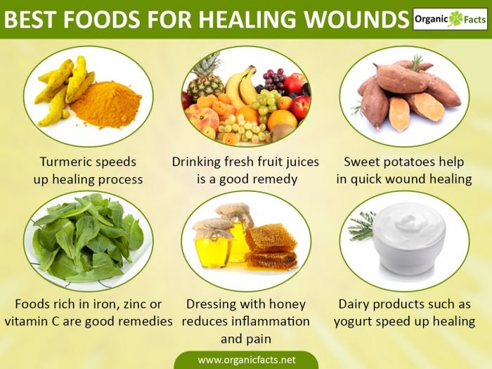 An infographic on best foods for healing wounds