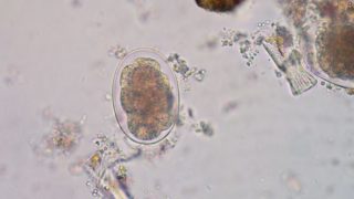 在粪便钩虫的鸡蛋通过显微镜看到的