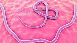 蜗杆侵染的2D说明在人肠