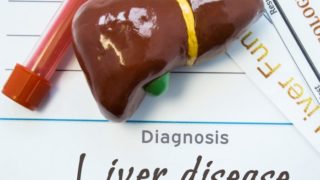 不健康的前瞻性肝放置在白板它说“肝病”底部