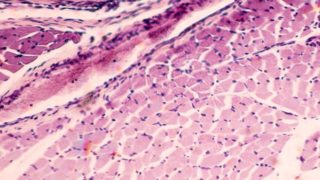 极端特写肌肉组织。