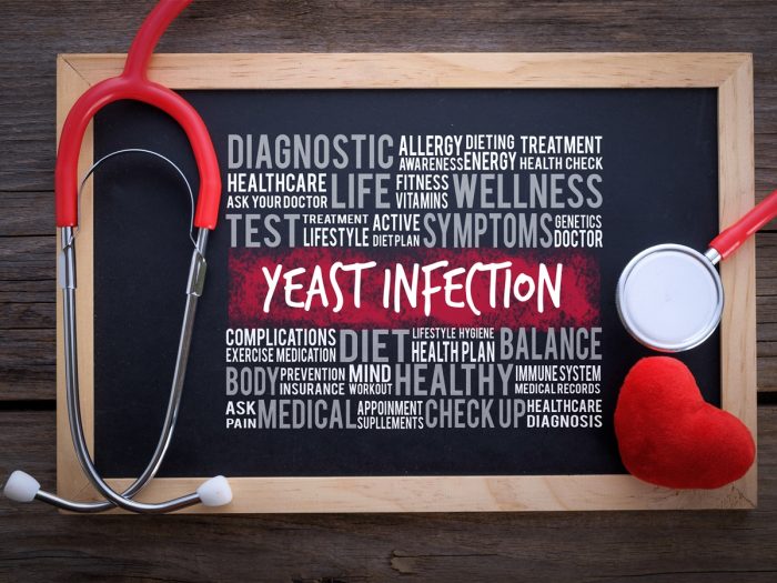 一块有木制边框的黑板,上面写着“酵母感染”和其他与健康相关的文字以及听诊器