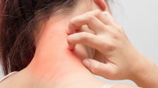 一个患有瘙痒的年轻女子，挠她的脖子